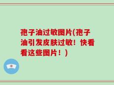 孢子油过敏图片(孢子油引发皮肤过敏！快看看这些图片！)