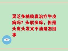 灵芝多糖胶囊治疗牛皮癣吗？头屑多痒，但是头皮头发又不油是怎回事