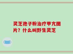 灵芝孢子粉治疗甲亢图片？什么叫野生灵芝