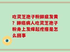吃灵芝孢子粉脚底发黄？肺癌病人吃灵芝孢子粉身上发痒起疙瘩是怎么回事