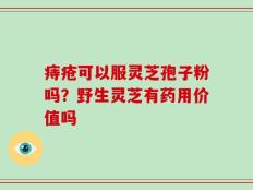 痔疮可以服灵芝孢子粉吗？野生灵芝有药用价值吗
