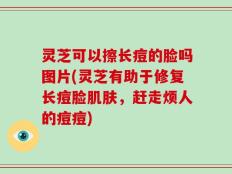 灵芝可以擦长痘的脸吗图片(灵芝有助于修复长痘脸肌肤，赶走烦人的痘痘)