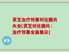灵芝治疗效果对比图片大全(灵芝对比图片：治疗效果全面展示)