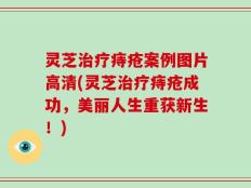 灵芝治疗痔疮案例图片高清(灵芝治疗痔疮成功，美丽人生重获新生！)
