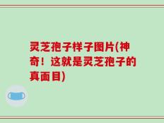 灵芝孢子样子图片(神奇！这就是灵芝孢子的真面目)