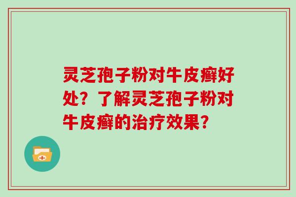 灵芝孢子粉对牛皮癣好处？了解灵芝孢子粉对牛皮癣的治疗效果？