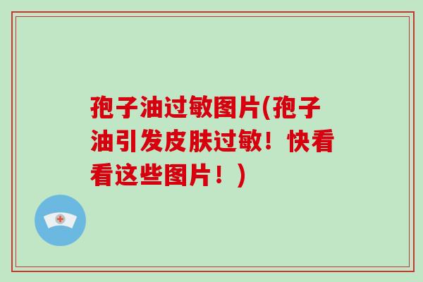 孢子油过敏图片(孢子油引发皮肤过敏！快看看这些图片！)