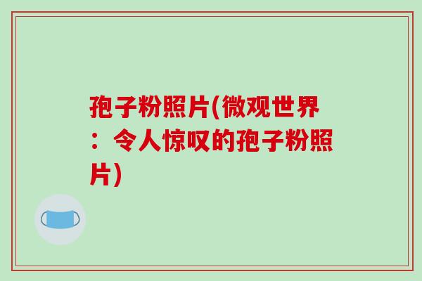孢子粉照片(微观世界：令人惊叹的孢子粉照片)