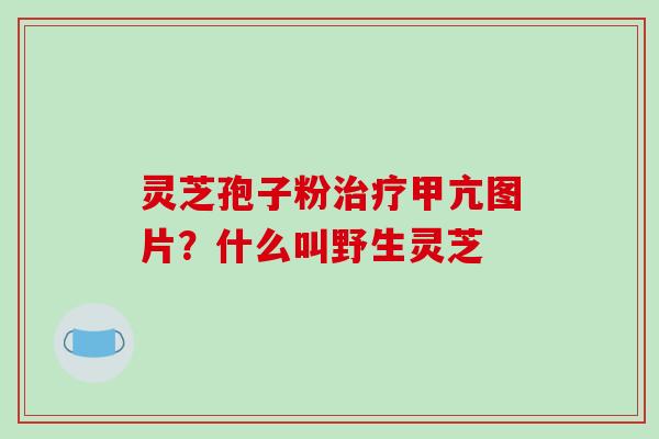 灵芝孢子粉治疗甲亢图片？什么叫野生灵芝