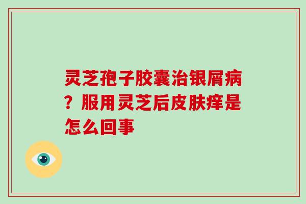 灵芝孢子胶囊治银屑病？服用灵芝后皮肤痒是怎么回事
