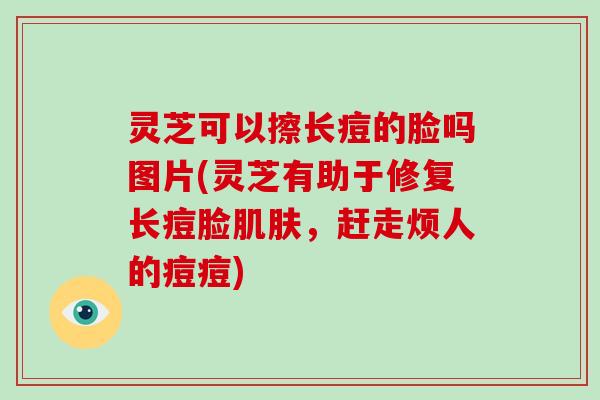 灵芝可以擦长痘的脸吗图片(灵芝有助于修复长痘脸肌肤,赶走烦人的痘痘)