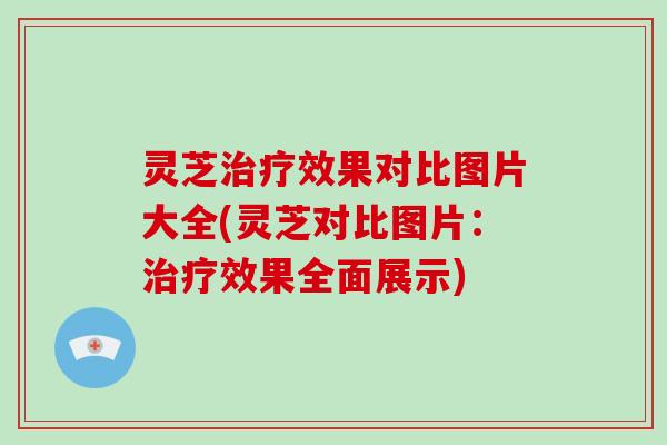 灵芝治疗效果对比图片大全(灵芝对比图片：治疗效果全面展示)