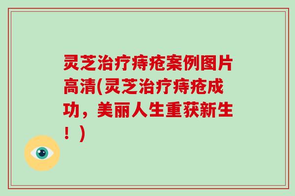 灵芝治疗痔疮案例图片高清(灵芝治疗痔疮成功，美丽人生重获新生！)