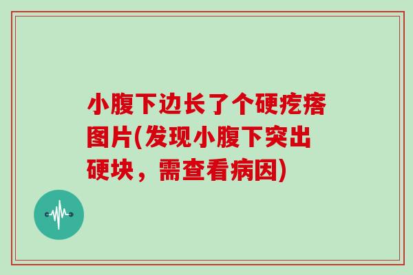 小腹下边长了个硬疙瘩图片(发现小腹下突出硬块,需查看病因)